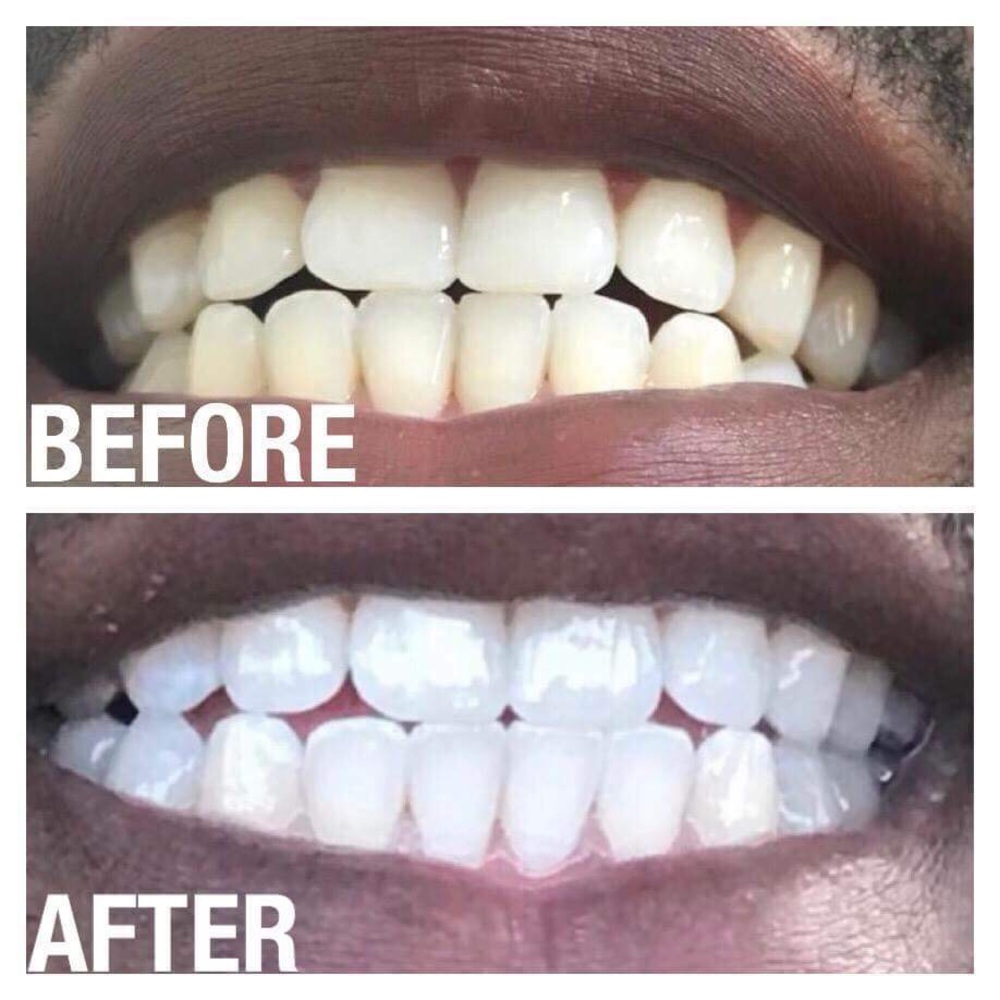 Whitening Toothpaste!! - Picture 4 of 6